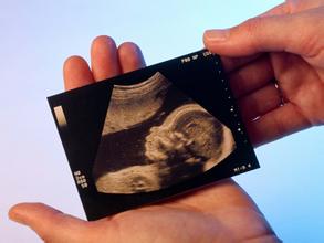 孕期需要做幾次四維彩超