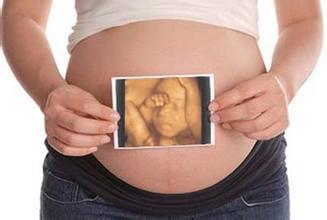 四維彩超是什么